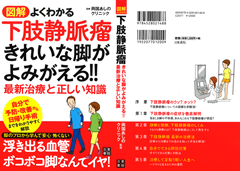 図解 よくわかる下肢静脈瘤 きれいな足がよみがえる!! 最新治療と正しい知識