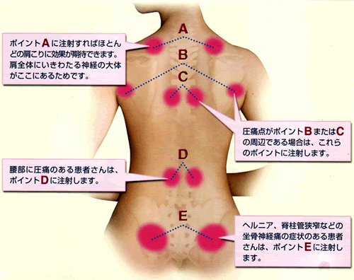 注射の場所