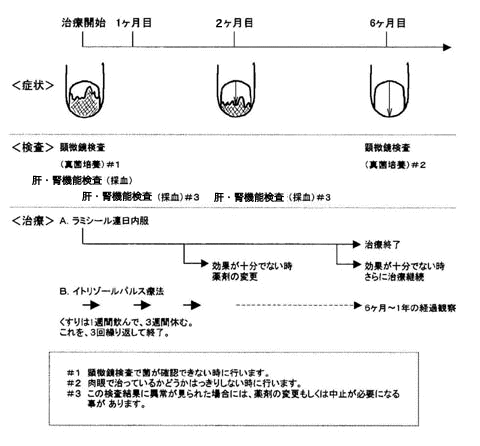 治療のスケジュール